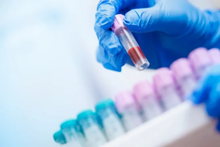 Jak przygotować się do badań laboratoryjnych? Kompleksowy poradnik