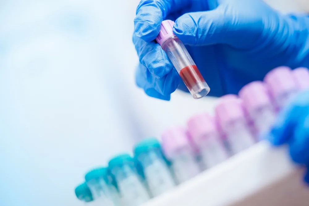 Jak przygotować się do&nbsp;badań laboratoryjnych? Kompleksowy poradnik Józefosław Medical Center